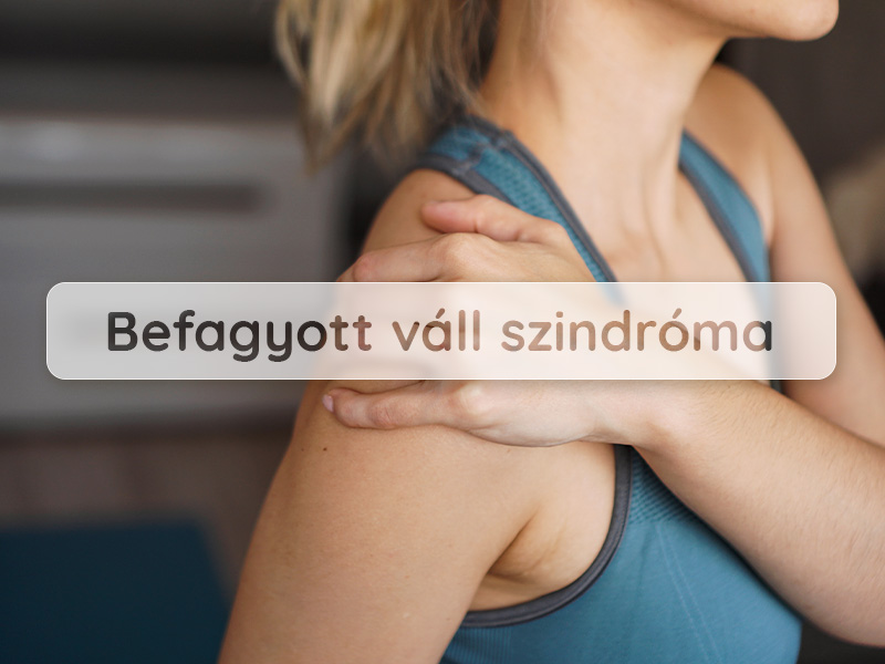 Befagyott váll szindróma